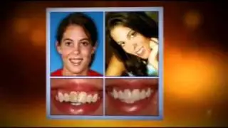 Dentists Winchester|What Are The Different Types Of Dentist