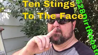 Beekeeper Beauty Tips by 628 Dirt Rooster - Get Fuller Lips and Rosy Cheeks With Bee Stings