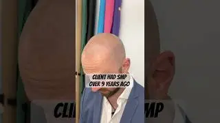 What does Scalp Pigmentation look like after 9 years?