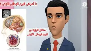 الورم الوعائى الكهفى A CAVERNOUS ANGIOMA (CAVERNOUS MALFORMATION, CAVERNOMA)?