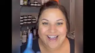 Watch me give myself a PCA Ultra Peel