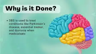Deep Brain Stimulation