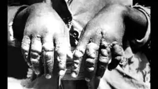 Erroro ዕሮሮ (በዶክተር ከበደ ሚካኤል)