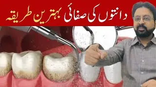 Teeth Deep Cleaning at Dentist to STOP Gum Recession
