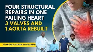 Successful Multi-Valve Heart Surgery Restores Health | Expert Cardiac Care by Dr. Naresh Kumar P V