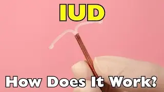 How Does an IUD Work?
