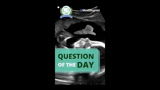 #USMLE Style Step 1 Practice Question | MCQ 104