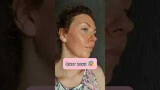 #Пилинг или #ожог ?