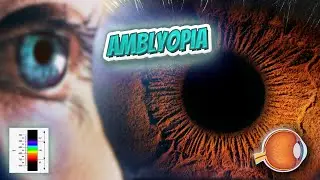 amblyopia (Every English Word Pronounced) 📕🔊🗣️😎✅