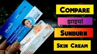 Skinshine vs Ultrabrite skin cream review | Face Beauty & Glow Tips 