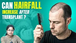 Hair Fall After Transplant? Don’t Panic! Here's Why It Happens 🤯