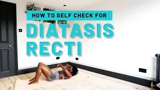 How to  Quickly Check if you have Diastasis Recti and Measure the Size using your Fingers