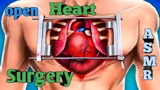 Experience the Chills: ASMR Surgery for Your Heart || ASMR Open Heart Care Animation