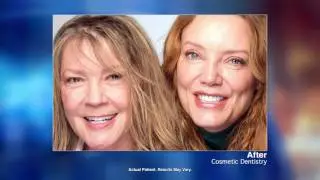 Smile Makeovers with Beverly Hills Cosmetic Dentist Dr. David Frey