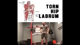 Torn Hip Labrum? DO THIS NOW! | SmashweRx | Trevor Bachmeyer
