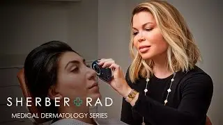 Inflammatory Skin Conditions: Rosacea