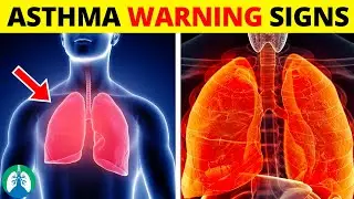 Top Early Warning Signs of Asthma That You Should NEVER IGNORE