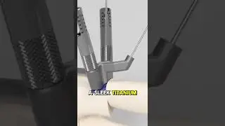 Trilliant Surgical   Minimally Invasive Bunion Pla