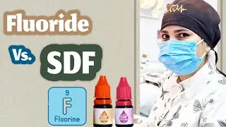 Fluoride vs. Silver Diamine Fluoride