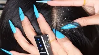 🎧 ASMR Close-Up Scalp Check with Nails | Hair Brushing, Mic Scratching & Deep Relaxation #DN520