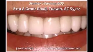 best dentist in tucson