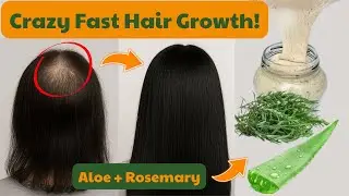 DIY Aloe Vera & Rosemary Shampoo | Natural Hair Growth, Hydration & Dandruff Control
