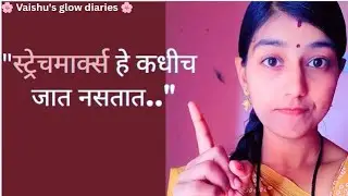 Stretch Marks काढणारी Cream खरंच काम करते का? | Medical Truth in Marathi 
