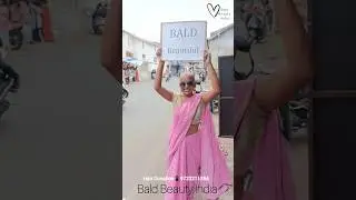 BALD Is Beautiful