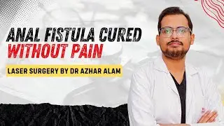 Anal Fistula Cured Without Pain | Laser Surgery by Dr Azhar Alam