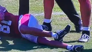 HORRIBLE LEG INJURY FOR STANFORD'S BRYCEN TREMAYNE VS OREGON