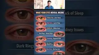 WHAT YOUR EYES REVEAL INSIDE #shortsfeed #rajeshhealthtalks #medicine #ytshorts