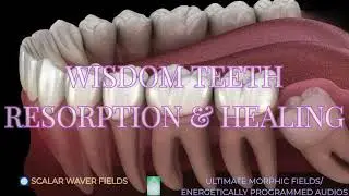 Wisdom Teeth Resorption & Healing PREMIUM SUPERCHARGED ULTRA POWERFUL!!!(Energetic In-formation)