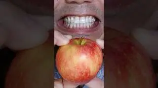 Satisfying Apple 🍎 ASMR #DoctorTristanPeh #ASMR #Apple