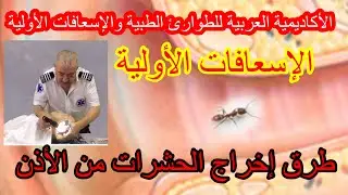 @إسعافات أولية وطوارئ طيبة #كيف-تخرج_الحشرة_الحشرات_من_الأذن#(56)2022#عبدالقادر_صوالحة
