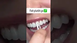 faites glisser le fil contre la surface de chaque dent en formant un &laquo; C &raquo;