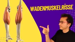 WADENMUSKELRISSE