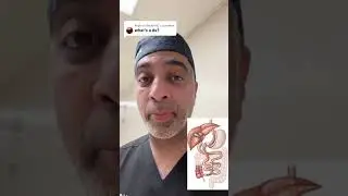 What Is a Duodenal Switch? | DFW Bariatrics & General Surgery