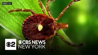 New Jersey man is 1st person to die from meat allergy spread by ticks