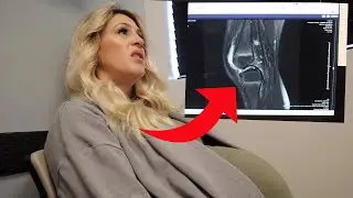 Frustrating MRI READING