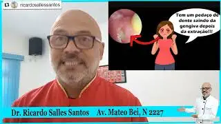 Pedaço de osso (espiculas) preso na gengiva após extração dentária