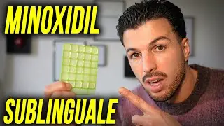 IL MINOXIDIL SUBLINGUALE FUNZIONA? rischi/benefici/costi