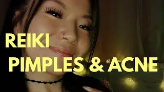 🧖🏻&zwj;♀️Glowing Skin🌝Clearing Acne, Pimples, Blemishes & Hyperpigmentation, Reiki Healing