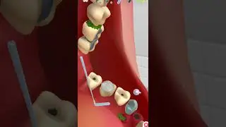 Dental game 2 | #gaming #newpuzzlegame #games #crazygame #dentalgame