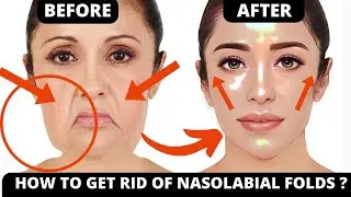No Fillers Needed! Face Yoga to Lift Laugh Lines & Smile Lines, Saggy Skin Naturally | 15 min