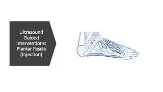 Plantar Fascia Injection Under Ultrasound | PRP & Steroid Techniques Explained