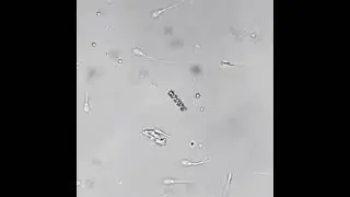 Amazing technology. A motorized nanobot helping a sperm with motility issues along towards an egg