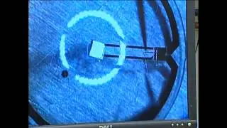 Archive: UW 360 - April 2011:  Bionic Eye
