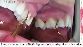XP Sharpen-Free Eagle Claw