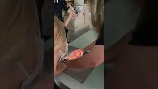 Wrist   flexion radial deviation