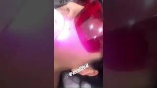 D&ouml;rt mevsim lazer epilasyon &ldquo;EVALİFE8&rdquo;